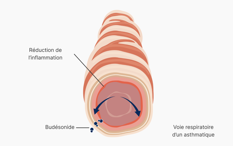 Mode d’action du budésonide – réduction de l’inflammation