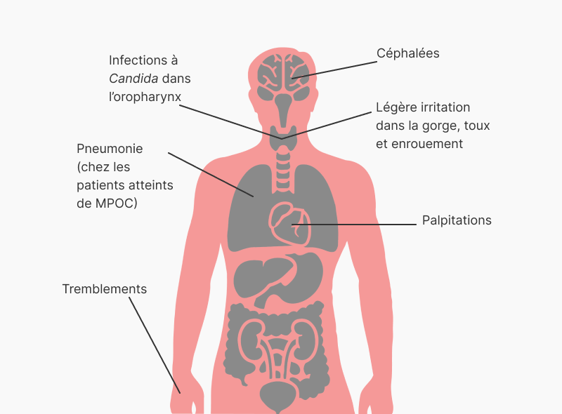 Palpitations, infections à Candida dans l’oropharynx, pneumonie (chez les patients atteints de MPOC), céphalées, tremblements, légère irritation dans la gorge, toux et enrouement